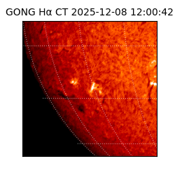 gong - 2025-12-08T12:00:42