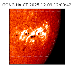 gong - 2025-12-09T12:00:42