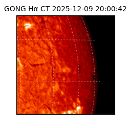 gong - 2025-12-09T20:00:42