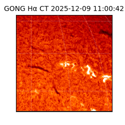 gong - 2025-12-09T11:00:42