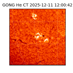 gong - 2025-12-11T12:00:42