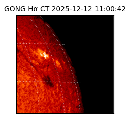 gong - 2025-12-12T11:00:42