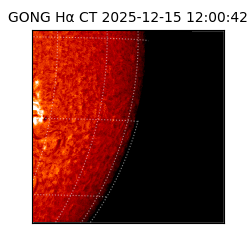 gong - 2025-12-15T12:00:42