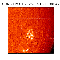 gong - 2025-12-15T11:00:42