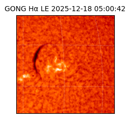 gong - 2025-12-18T05:00:42