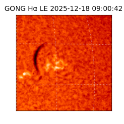 gong - 2025-12-18T09:00:42