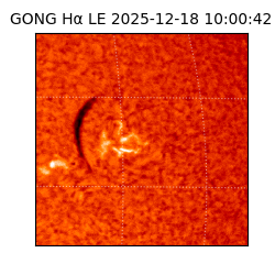 gong - 2025-12-18T10:00:42