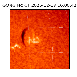 gong - 2025-12-18T16:00:42