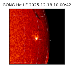 gong - 2025-12-18T10:00:42
