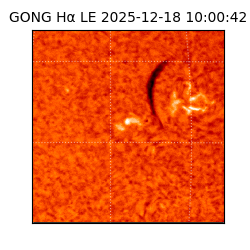 gong - 2025-12-18T10:00:42