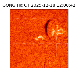 gong - 2025-12-18T12:00:42