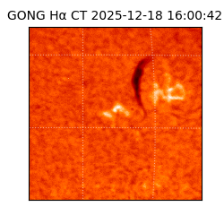 gong - 2025-12-18T16:00:42