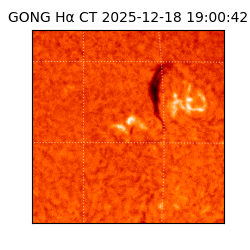 gong - 2025-12-18T19:00:42