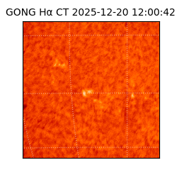 gong - 2025-12-20T12:00:42