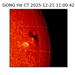 gong - 2025-12-21T11:00:42