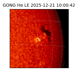 gong - 2025-12-21T10:00:42