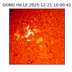 gong - 2025-12-21T10:00:42