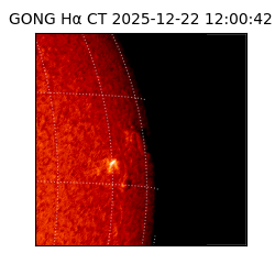 gong - 2025-12-22T12:00:42