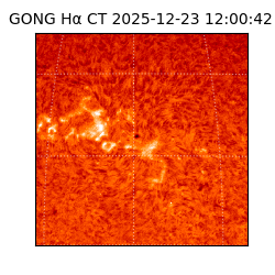 gong - 2025-12-23T12:00:42