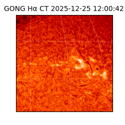 gong - 2025-12-25T12:00:42