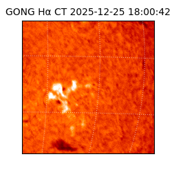 gong - 2025-12-25T18:00:42