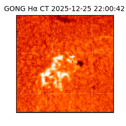 gong - 2025-12-25T22:00:42