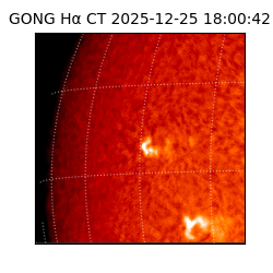 gong - 2025-12-25T18:00:42