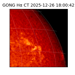 gong - 2025-12-26T18:00:42