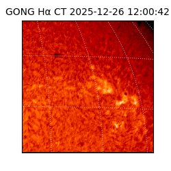 gong - 2025-12-26T12:00:42