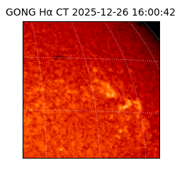 gong - 2025-12-26T16:00:42