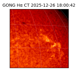 gong - 2025-12-26T18:00:42