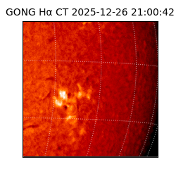 gong - 2025-12-26T21:00:42