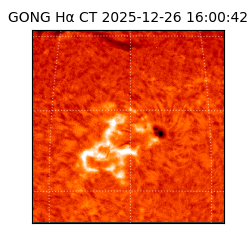 gong - 2025-12-26T16:00:42