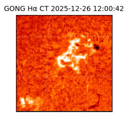gong - 2025-12-26T12:00:42