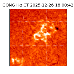gong - 2025-12-26T18:00:42