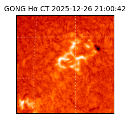 gong - 2025-12-26T21:00:42