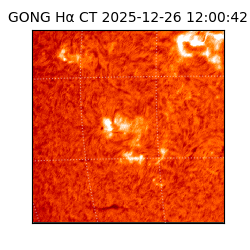 gong - 2025-12-26T12:00:42