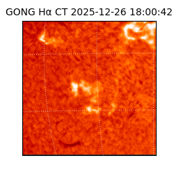 gong - 2025-12-26T18:00:42