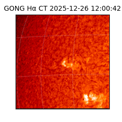 gong - 2025-12-26T12:00:42