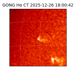 gong - 2025-12-26T18:00:42