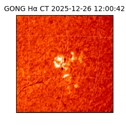 gong - 2025-12-26T12:00:42