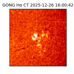 gong - 2025-12-26T16:00:42