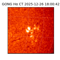 gong - 2025-12-26T18:00:42