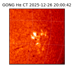 gong - 2025-12-26T20:00:42