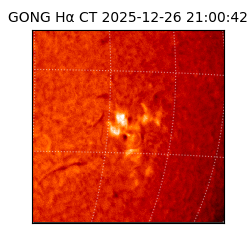 gong - 2025-12-26T21:00:42