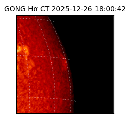 gong - 2025-12-26T18:00:42