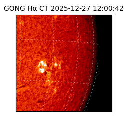 gong - 2025-12-27T12:00:42