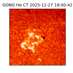gong - 2025-12-27T18:00:42
