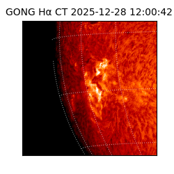 gong - 2025-12-28T12:00:42