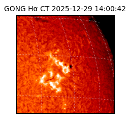 gong - 2025-12-29T14:00:42